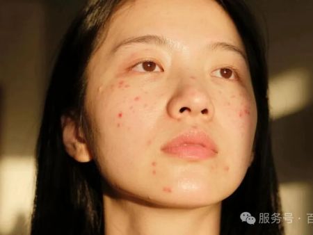 油敏肌的潔面難題終于有解！這款氨基酸潔面憑什么被問(wèn)爆？